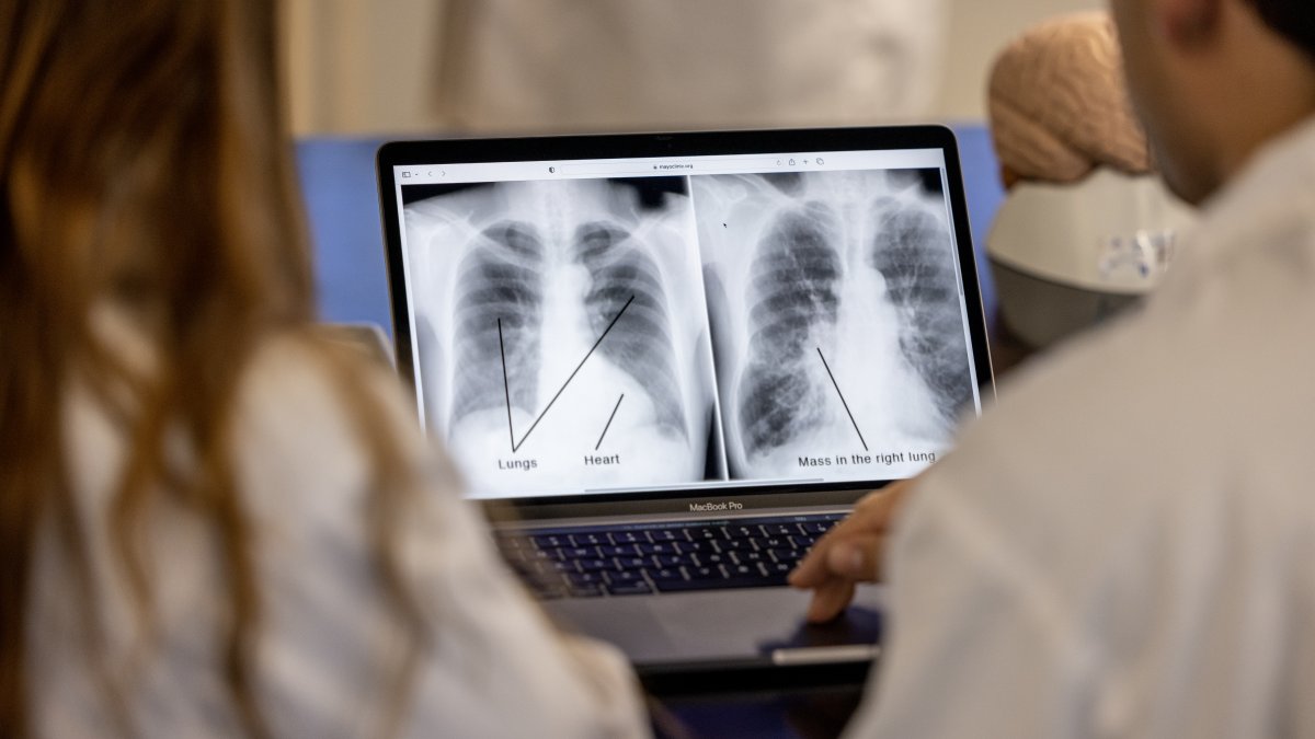 Image of students studying anatomy lecture pictures on their laptop.